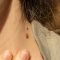 How To Remove Skin Tags Naturally?